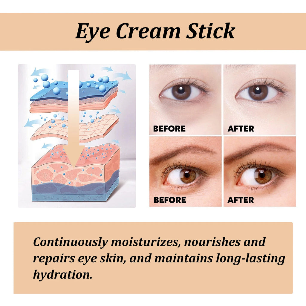 EyeRegen